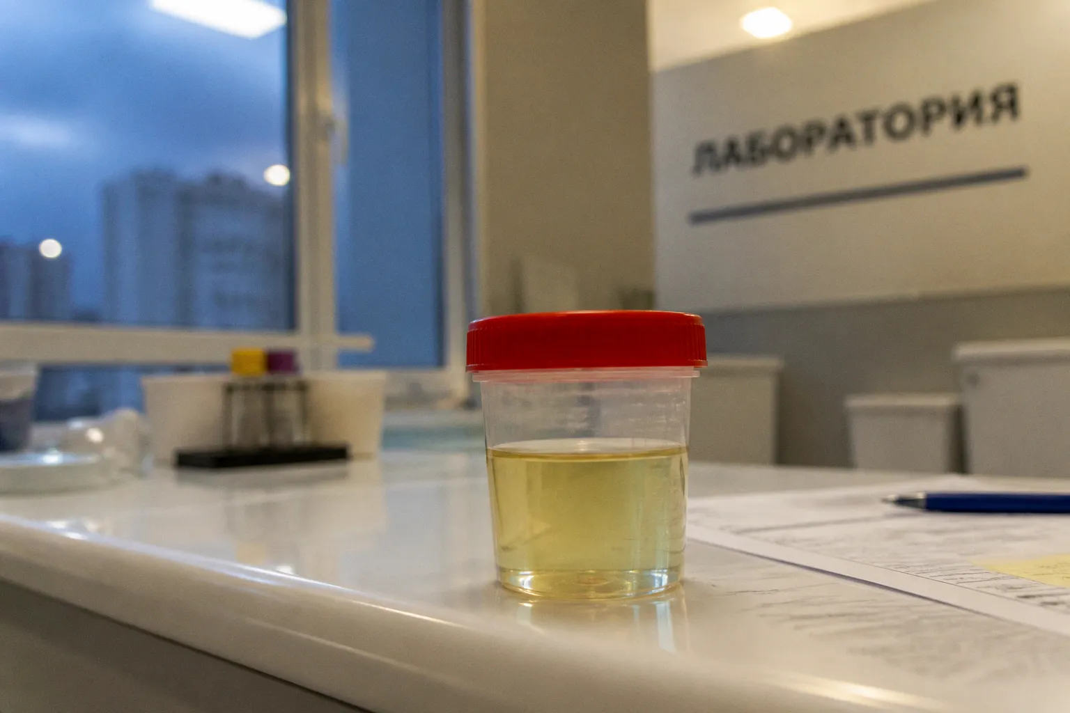Медицинские анализы мочи: что означают показатели?