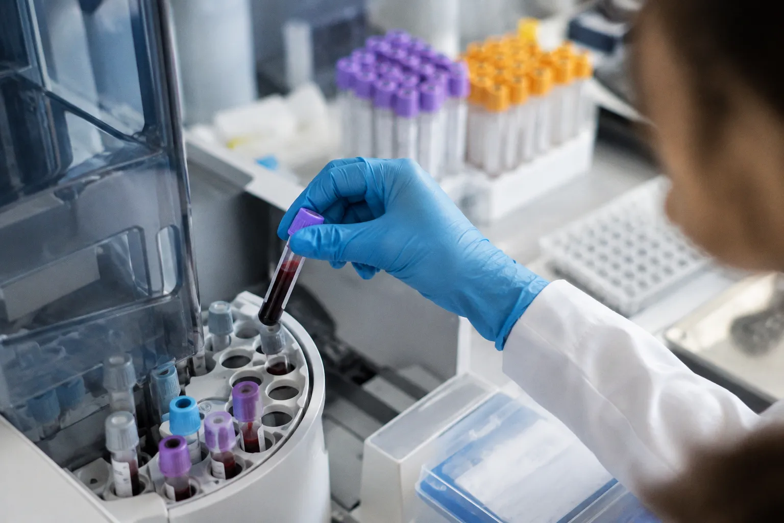 Можно ли обнаружить болезнь до появления симптомов: проект Mayo Clinic и Thermo Fisher